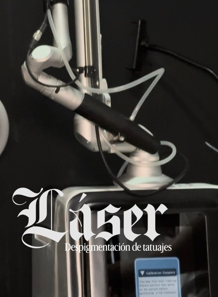 laser de tatuajes